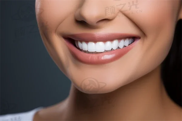 三门牙齿美白费用是多少？2025年牙齿美白价格表全解析，附带牙贴面价格信息。