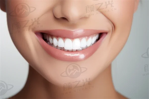 海南牙齿美白费用是多少？2025年牙齿美白价格详解，附加超薄瓷贴面美白的费用信息。