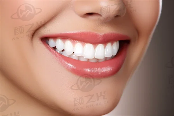 吉林志合口腔门诊部推出牙齿美白优惠活动，原价980元起现仅需680元起，助您轻松展现灿烂笑容！