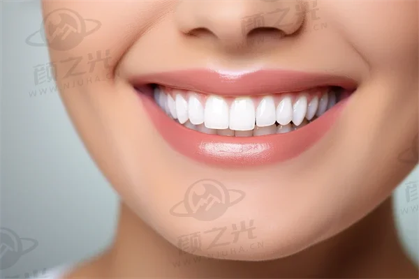赣州牙齿美白费用是多少？2025年牙齿美白价格详解及氟斑牙治疗费用简述