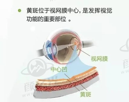 黄斑变性眼科疾病科普，内含真实治疗案例