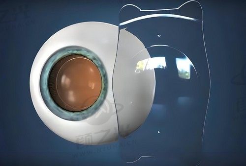 深东爱尔眼科臧晶医生做晶体植入2.6w起，解除高度近视的困扰