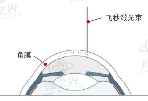 蒋海翔医生眼科技术怎么样？能做多种近视手术技术超好口碑也不错