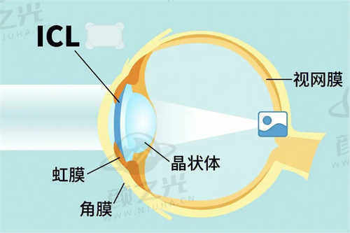 汪红主治医师作为华厦眼科技术骨干之一