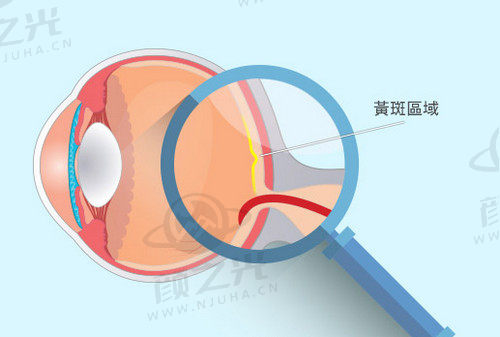 北京同仁眼科医院卢宁的技术扎实