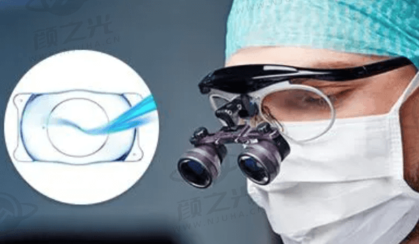 扬州爱尔眼科医院ICL晶体植入近视手术怎么样？