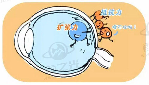 北京熙仁眼科医院王乐今做微创后巩膜加固手术技术不错