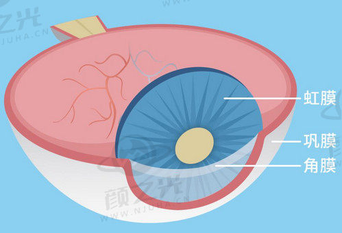 北京熙仁眼科医院王乐今做微创后巩膜加固手术技术高超