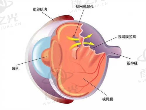 重庆南坪爱尔眼科医院怎么样.jpg