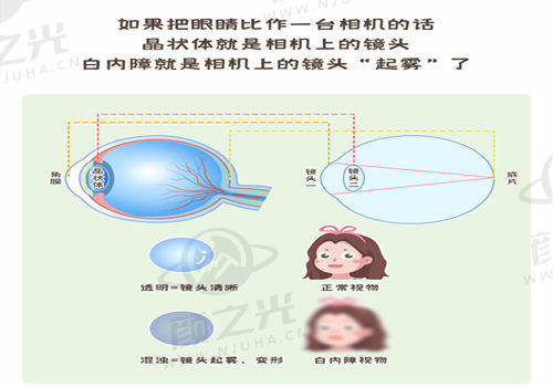 珠海希玛林顺潮眼科医院口碑