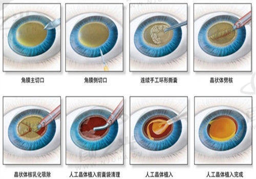 珠海希玛林顺潮眼科医院怎么样