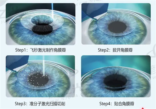 抚顺爱尔眼科医院怎么样