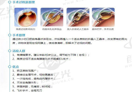 福州亮睛眼科医院白内障手术费用贵吗？