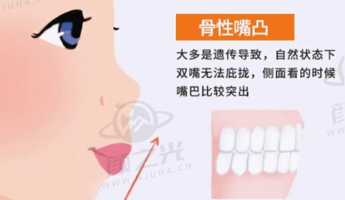 南通沪牙卫士口腔医院价格表来啦！牙齿矫正、种植牙等项目收费全知晓