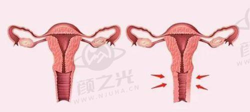 杭州连天美医疗美容医院怎么样？正规资质、强医团队与多元项目铸就可靠之选！