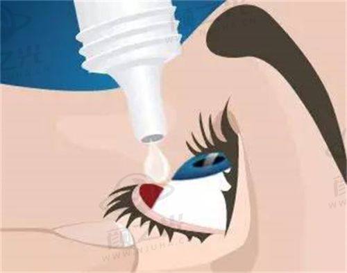 湛江捷康视眼科医院的价格收费