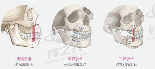 北京大麦微针植发：连锁专科优势多，合理价格享优质服务，多项技术助你重焕毛发风采！ 