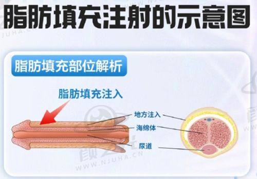 二、南阳天后：规模与技术的双重保护