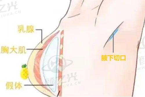 2025东莞整形医院排名前十位公布！揭秘前三医院风采及面部脂肪填充知识 