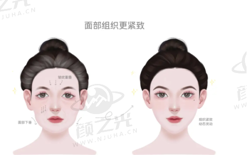 三、保定蓝山医疗美容医院