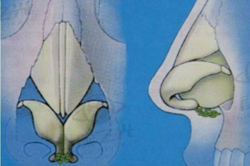 深圳八大处整形医院特色科室及技术亮点