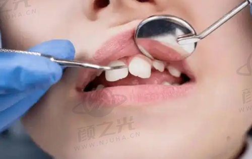 三、大连九诺口腔与康贝佳口腔服务大揭秘