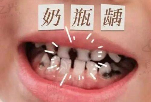 六、天津武清医博口腔门诊部优势总结