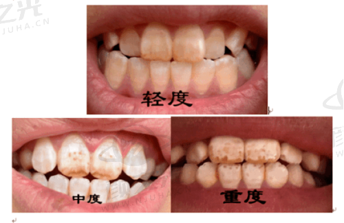 六、昆明松鼠口腔门诊部患者口碑