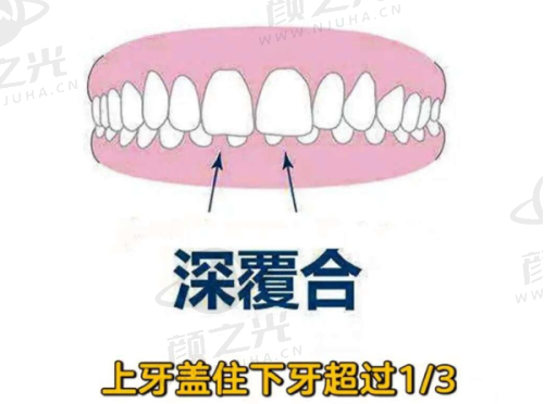 六、深圳福民鼎植口腔门诊部价格体系