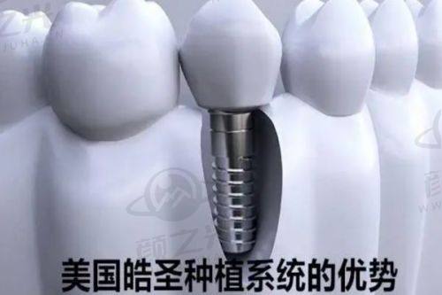二、大连九诺口腔与康贝佳口腔技术大比拼