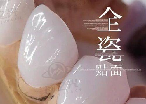 八、昆明松鼠口腔门诊部优惠活动