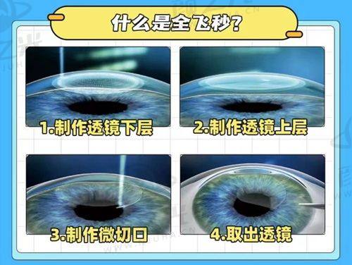 爱尔眼科各类眼科项目价格大揭秘！各地价格差异、地址及优势全知晓 