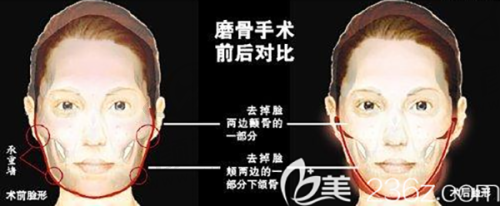 四、保定出色医疗美容整形医院