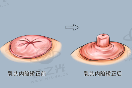 温州乐清艾美时光整形正规吗？经批准成立，项目多口碑好，医生靠谱！ 