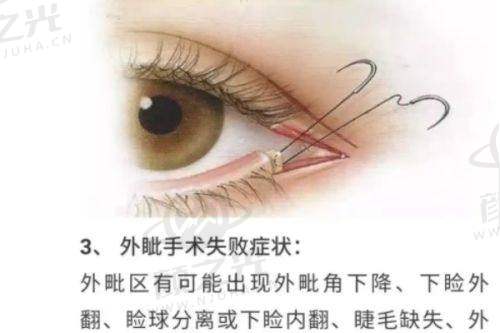 昆山玥美医疗美容门诊的交通与周边配套及预约方式
