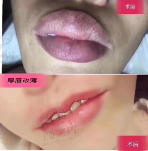 三、上海伊莱美医疗美容医院与上海华美医疗美容医院：大环境与高品质服务的较量