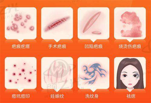 总结：大同京城医院植发收费到底贵不贵