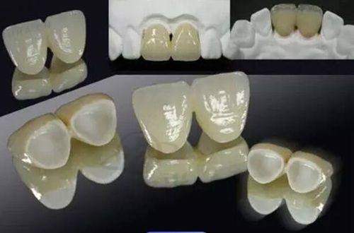 南昌拜博口腔是正规医院吗？二级资质多团队护航，种牙保价价格透明 
