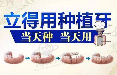 四川成都布莱梅联合口腔医院优势亮点