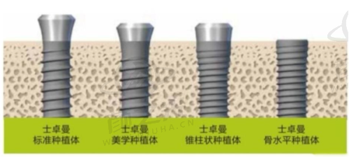 浙江丽水亮贝美口腔患者口碑如何？