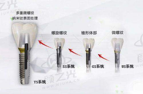 江西 南昌博德口腔医院有哪些特色项目和医生团队？