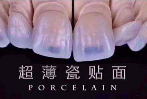 南昌博德口腔医院是正规医院吗?资质全服务优,技术设备先进可放心就医