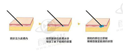 四、北京空美圣医整形服务怎么样？