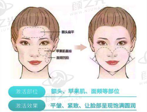 东莞紫芯医疗美容正规吗？资质、环境、口碑全揭秘，放心之选！ 