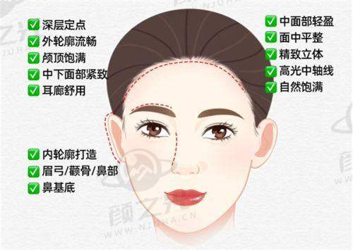 三、北京碧莲盛：不剃发植发模式与服务流程亮点