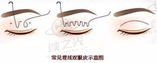 六、南昌大学医学校美容整形医院与吉安中 心人民医院整形美容科：特色项目对比