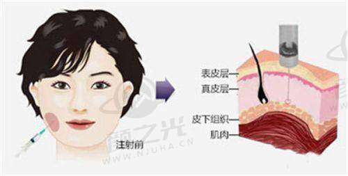 上海眼部整形排名前五医院揭秘：美联臣等各有专长，助你选对医美机构