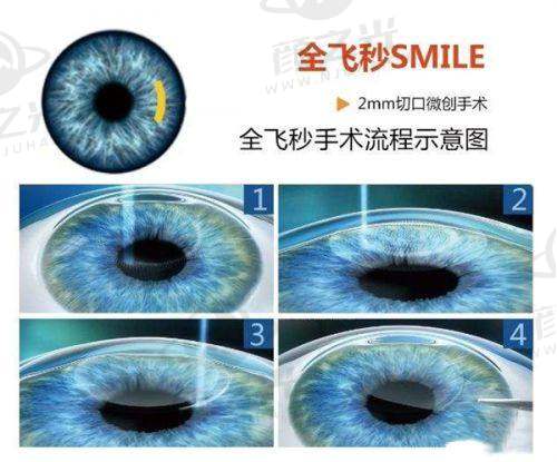 江门光明眼科医院服务质量与环境怎么样？