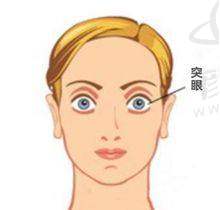 一、广西视光中 心激光近视手术价格
