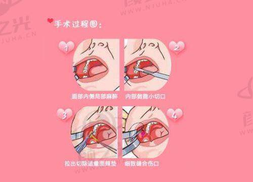 六、广州曙光医疗美容医院：一站式医美与高毛囊存活率优势